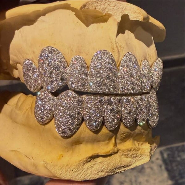 Diamond 8 on 8 Set
