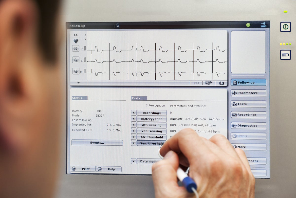 Behandeling-Pacemakerimplantatie / Patiënten-Behandeling | Hartcentrum ...