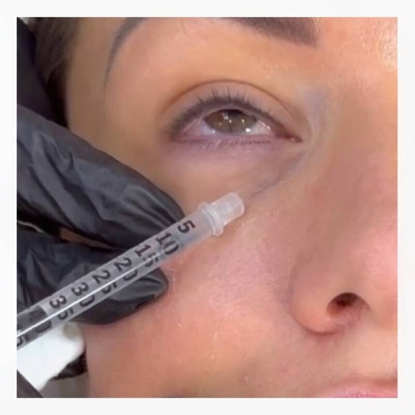 Skin booster Eye Rejuvination