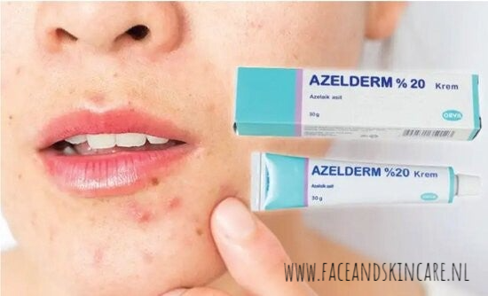 Azelderm %20 - Crème - Behandeling van Acné + Schimmels & Eczeem - Bekend Product