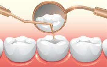 Routine Dental Care