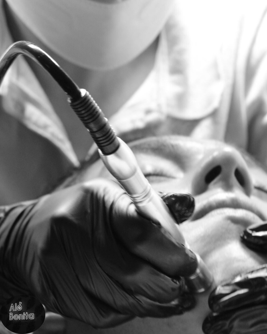 Limpieza Facial Profunda con Microdermoabrasion