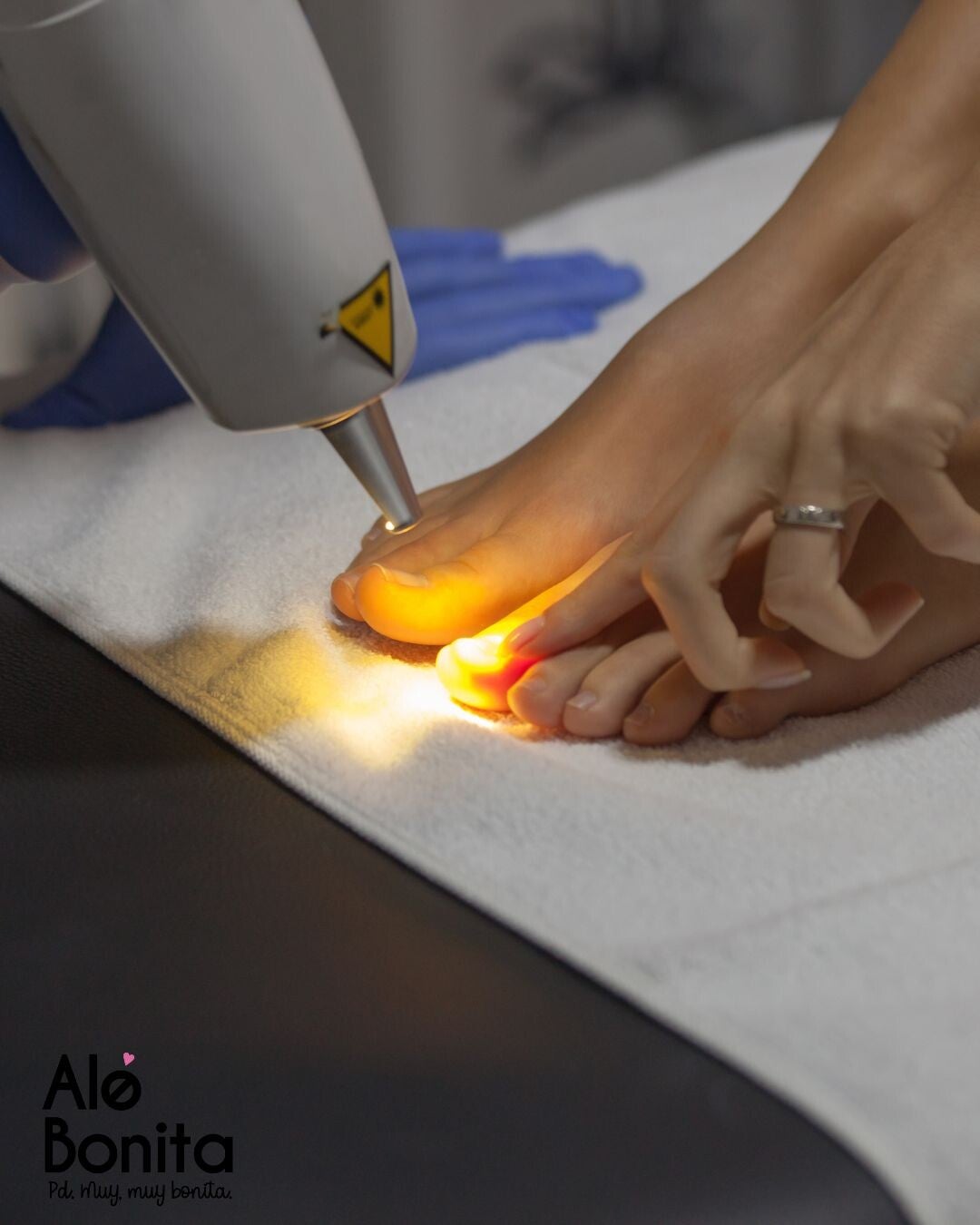 Depilación DIODO Dedos