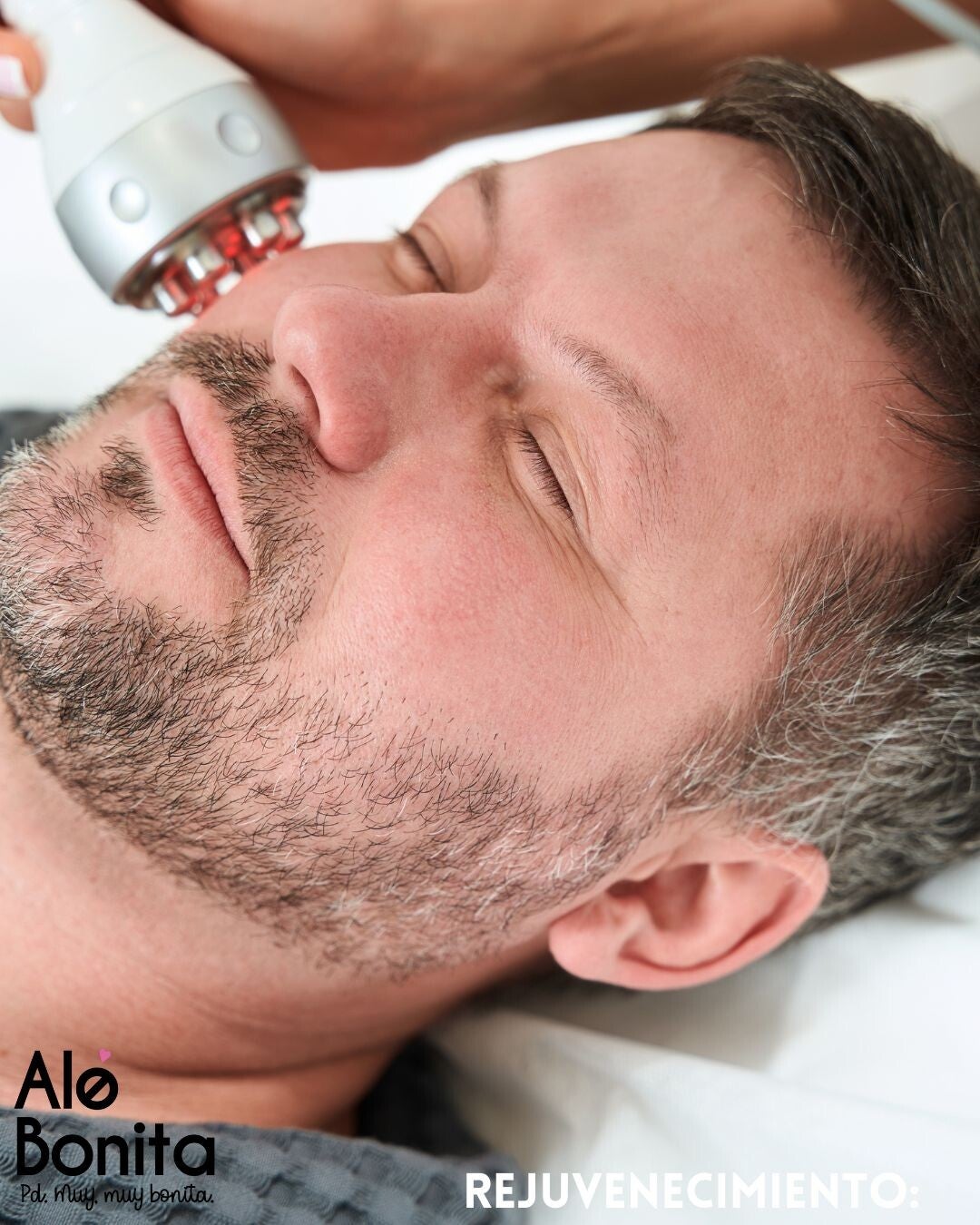 Facial Rejuvenecimiento (Radiofrecuencia)