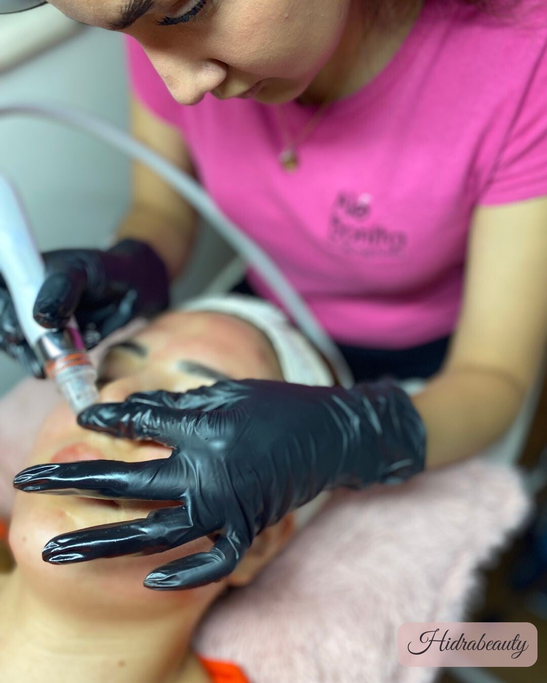 Facial Hidrabeauty (Hidra dermoabrasion)