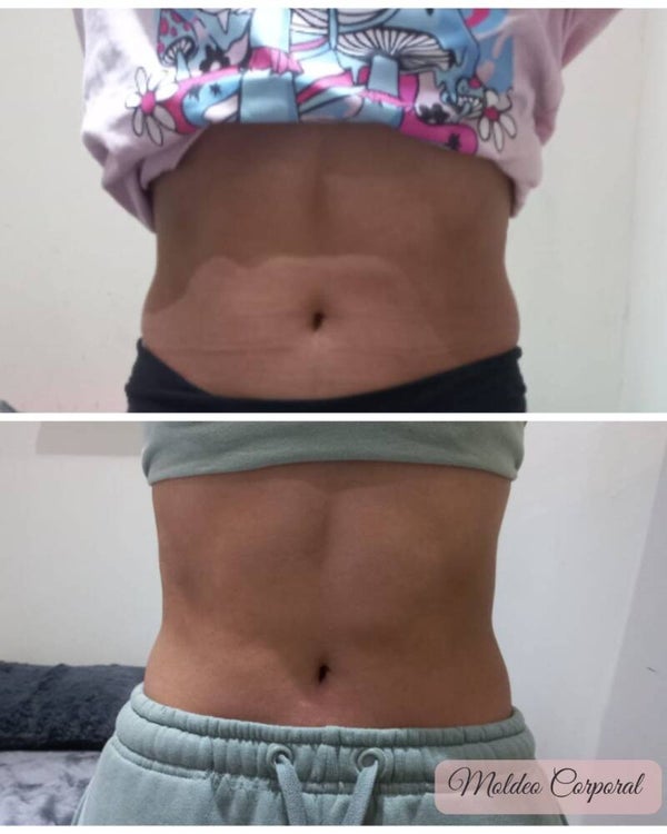 Reductivos Corporales