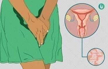 Mchoro fangasi ukeni Kuwasha 