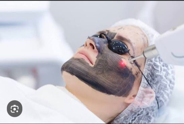 Peeling carbon  500€