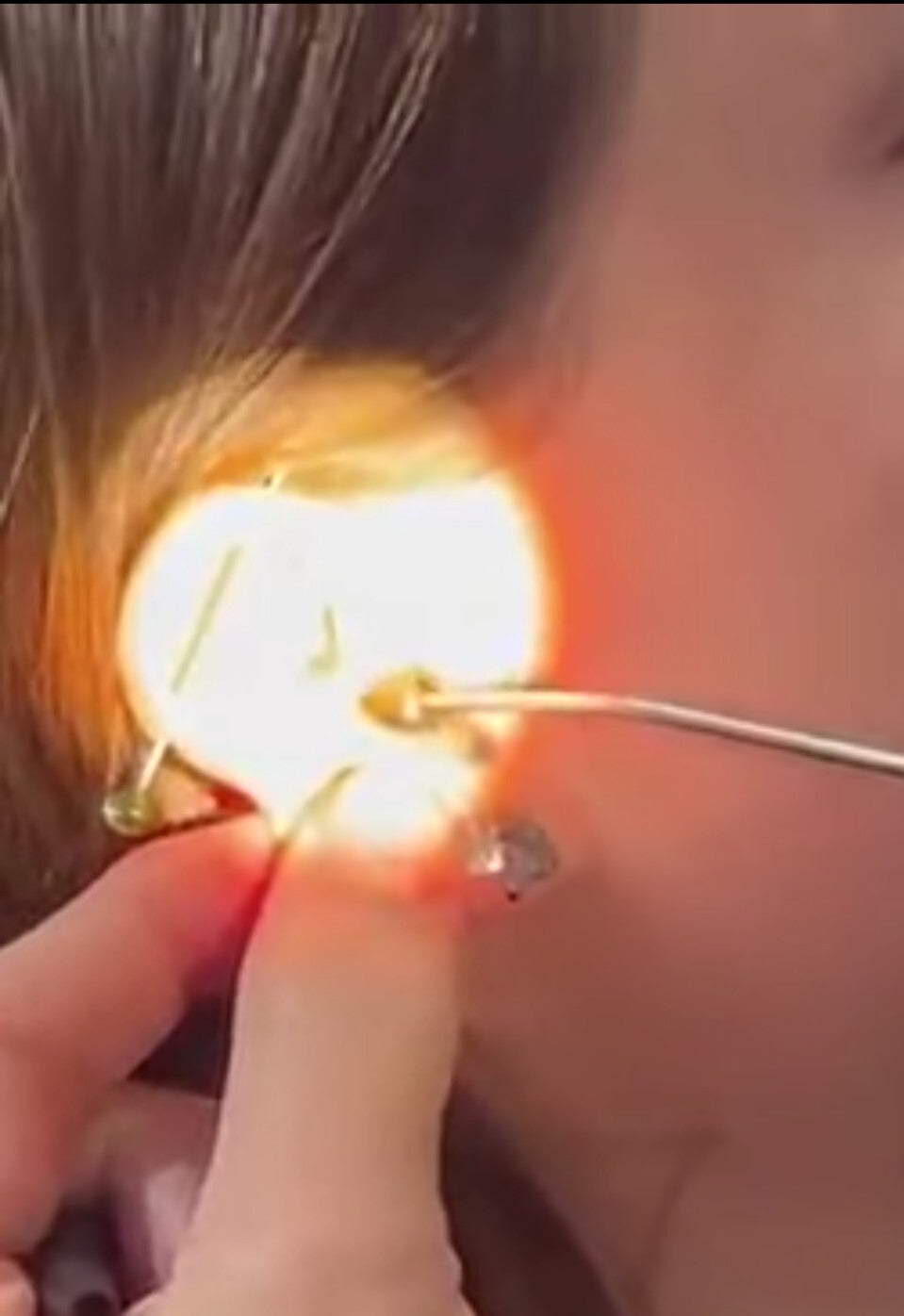 Best earwax Removal near me.