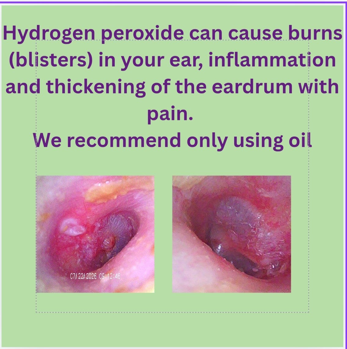 Hydrogen peroxide can burn your ears
