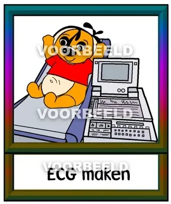 ECG maken