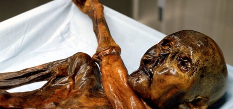 “Ötzi, la mummia preistorica dell’uomo venuto dal ghiaccio, corpo conservato ed esposto in contesto scientifico.”