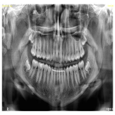 9_cs_8200_3d_pan_4-standard.png
