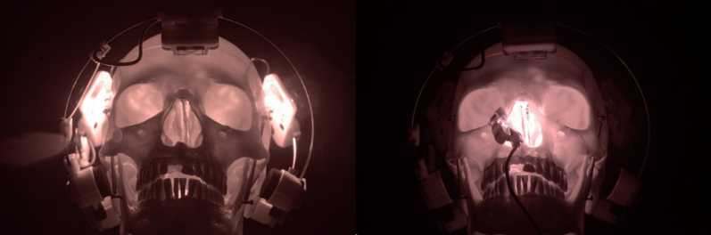 Pénétration de la lumière NIR à travers le crâne humain – Vielight Neuro