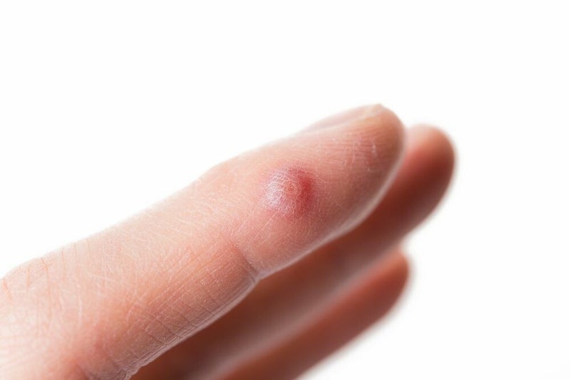 blog over wratten door reconnective healing bilthoven
