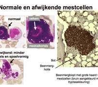 blog mastocytose door reconnective healing bilthoven