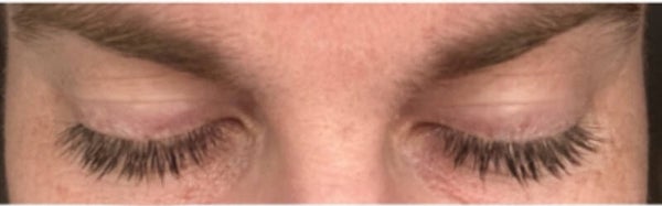 Lash/ brow growth consultation