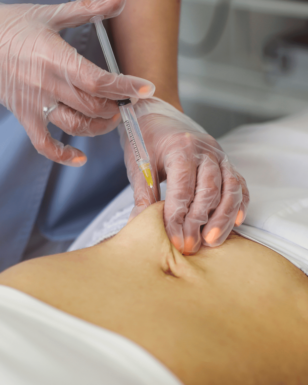 Fat Dissolving / Body Contouring in North London