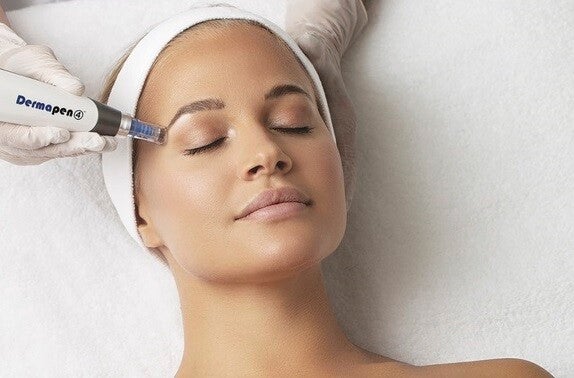 Microneedling Treatment in North London