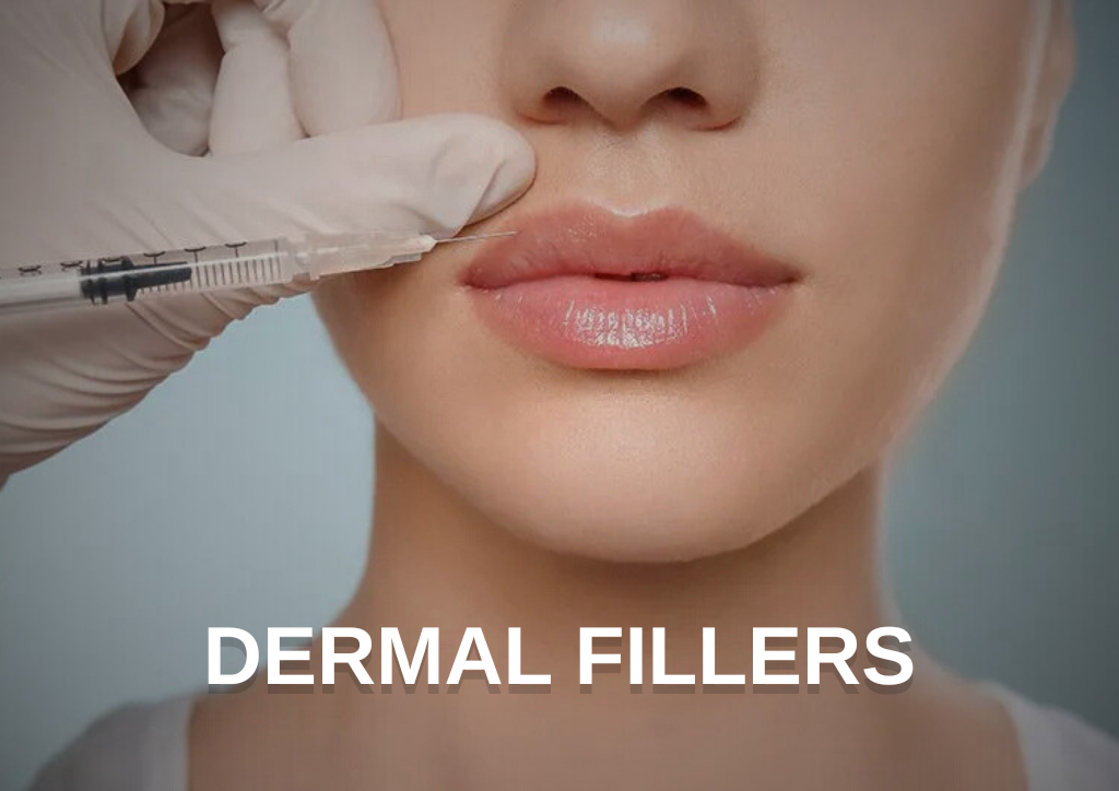 Lip fillers in Barnet