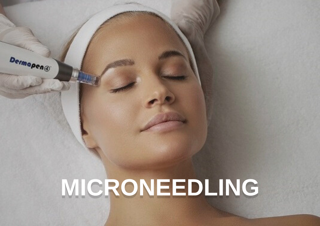 Microneedling in Barnet