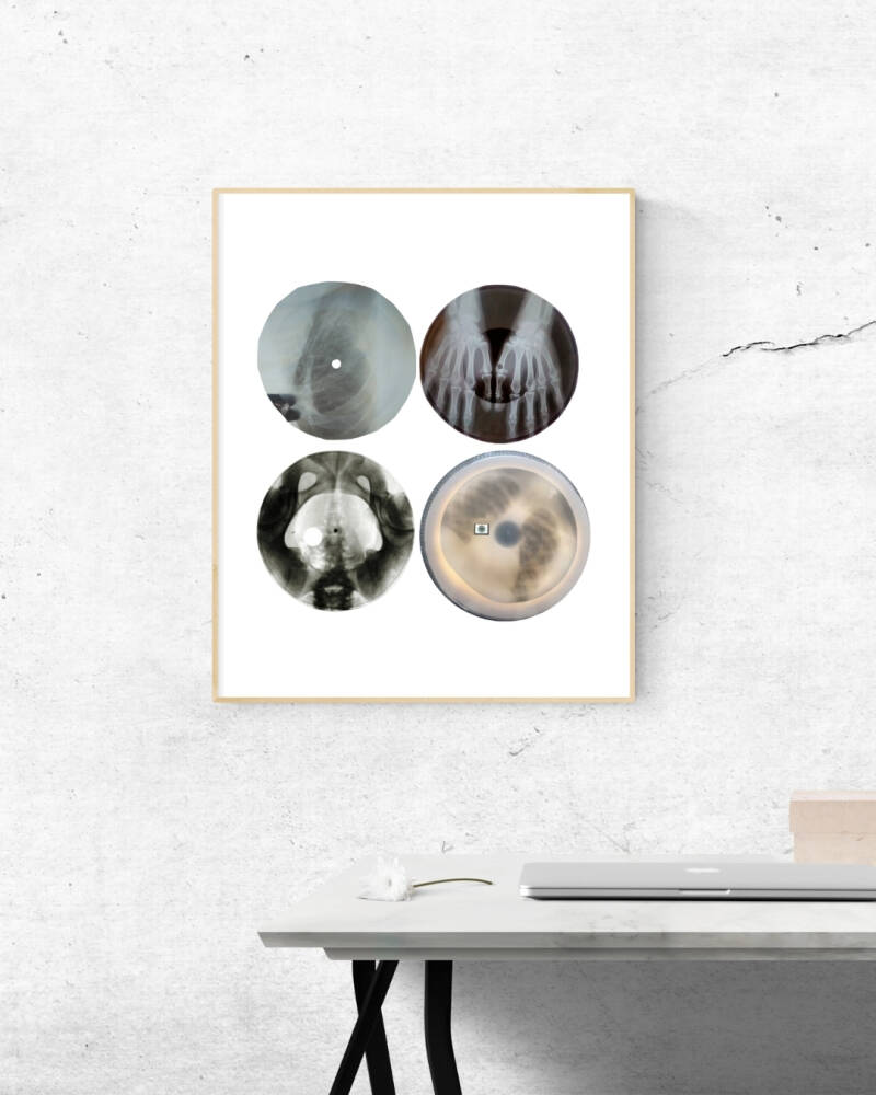 Bone music, artprint van collage van vintage vinyl gemaakt van x-rays. artprint in gelimiteerde oplage.