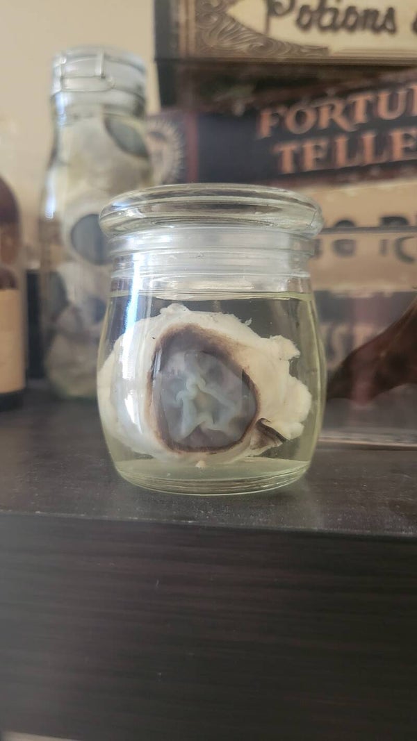 Eyeball