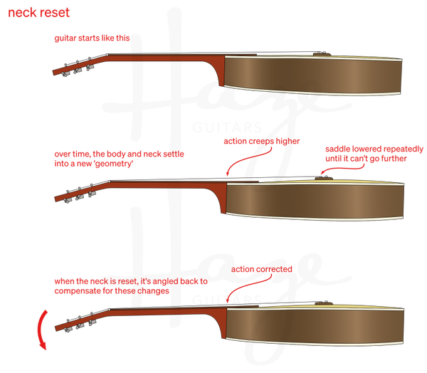Herplaatsen of positioneren van de hals.