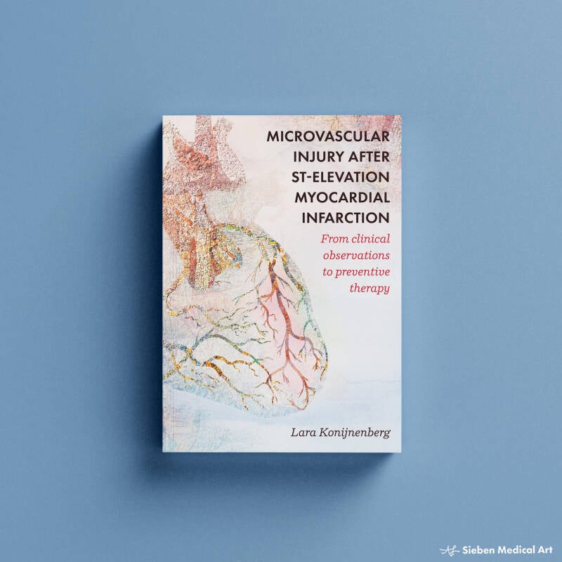 voorkant proefschrift cover over