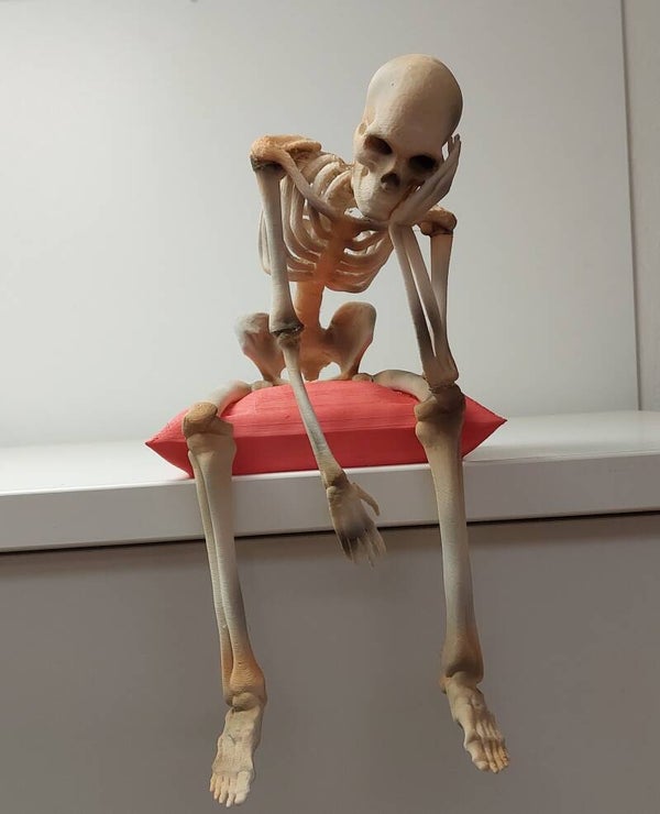 Depressiever Knochenmax