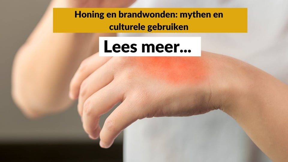 Honing bij brandwonden