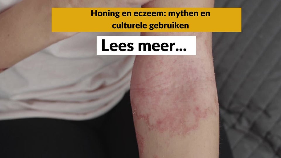 Honing tegen eczeem