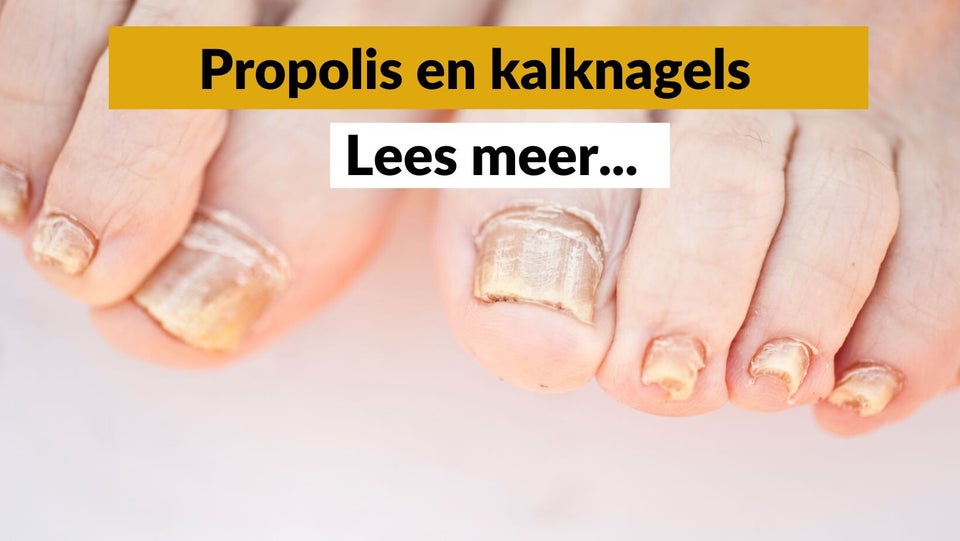 Propolis tegen kalknagels - Pure Honey