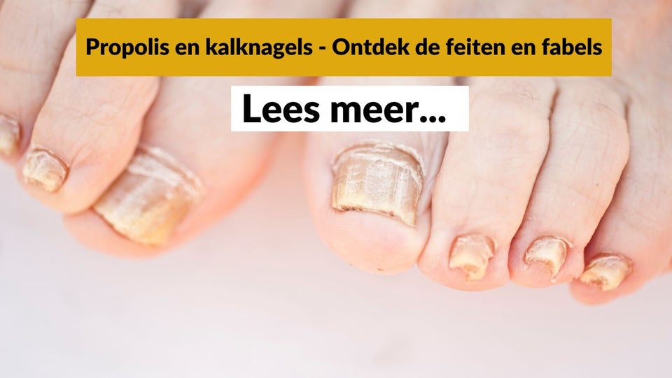 Propolis tegen kalknagels - Pure Honey