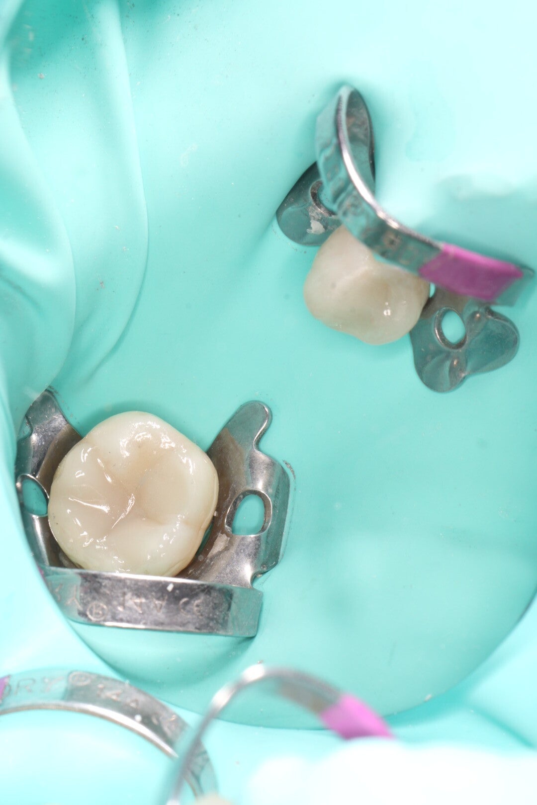 Resina dental terminada