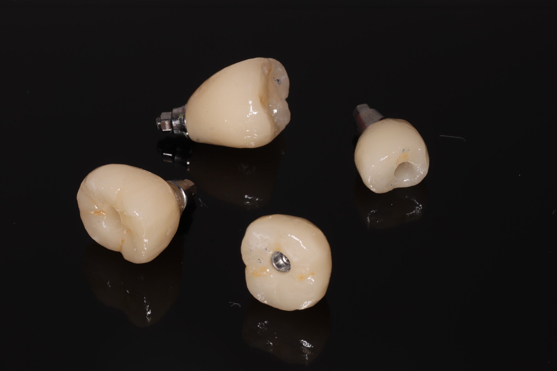 Coronas sobre implantes