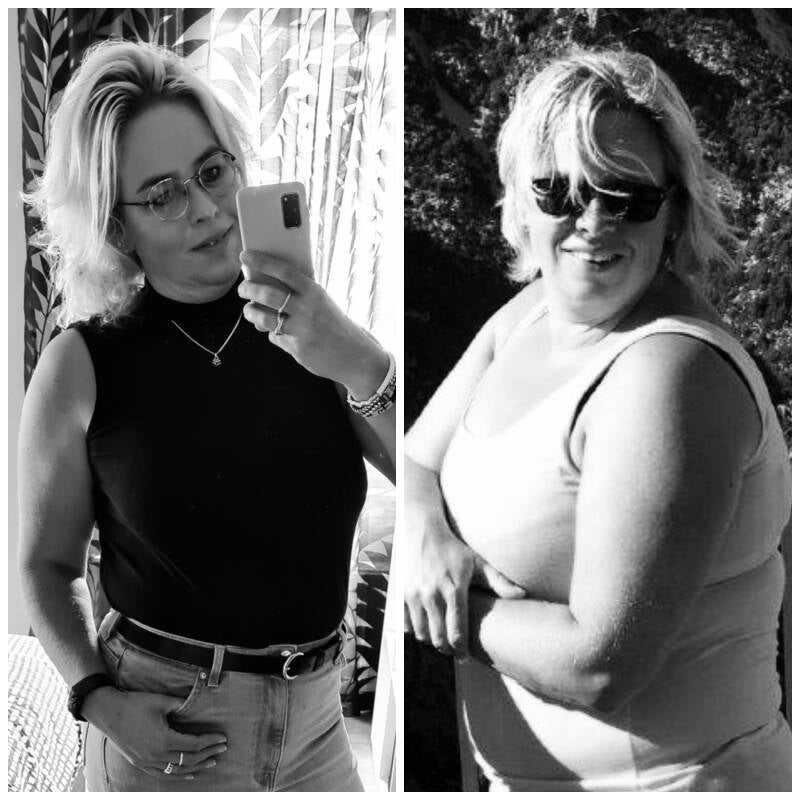 Karin Abbink buikwandcorrectie liposuctie velthuis kliniek Wiebren van den Berg plastische chirurgie