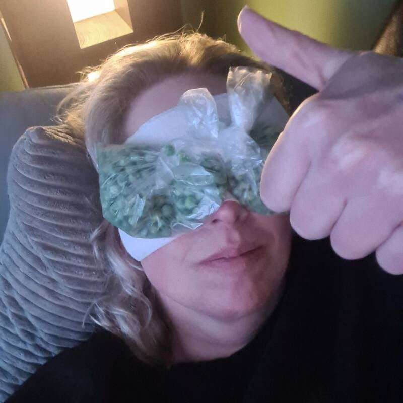 ooglidcorrecite velthuis kliniek Wiebren van den Berg plastische chirurg