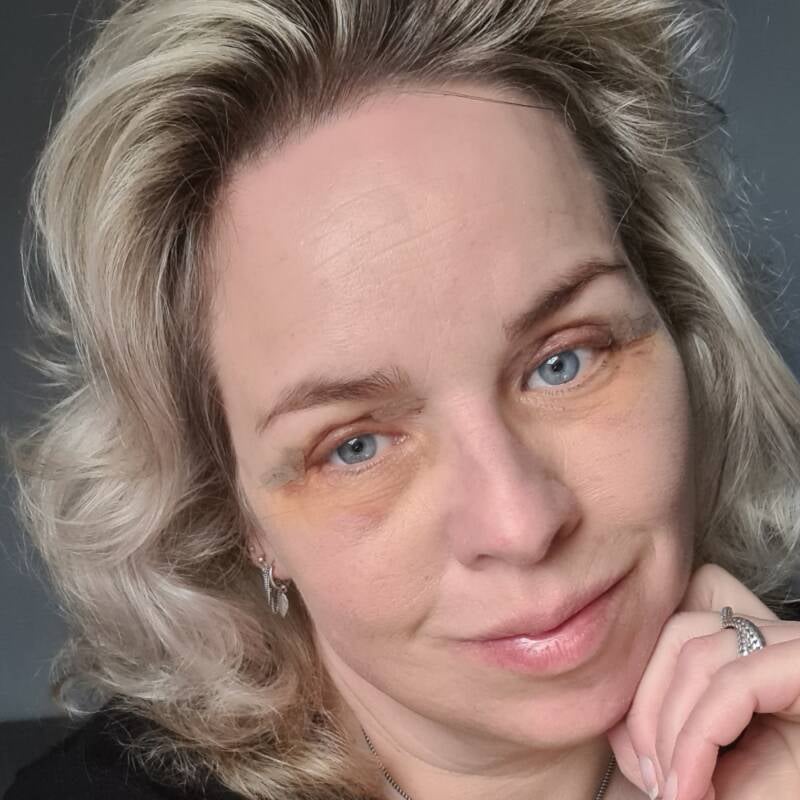 ooglidcorrecite velthuis kliniek Wiebren van den Berg plastische chirurg