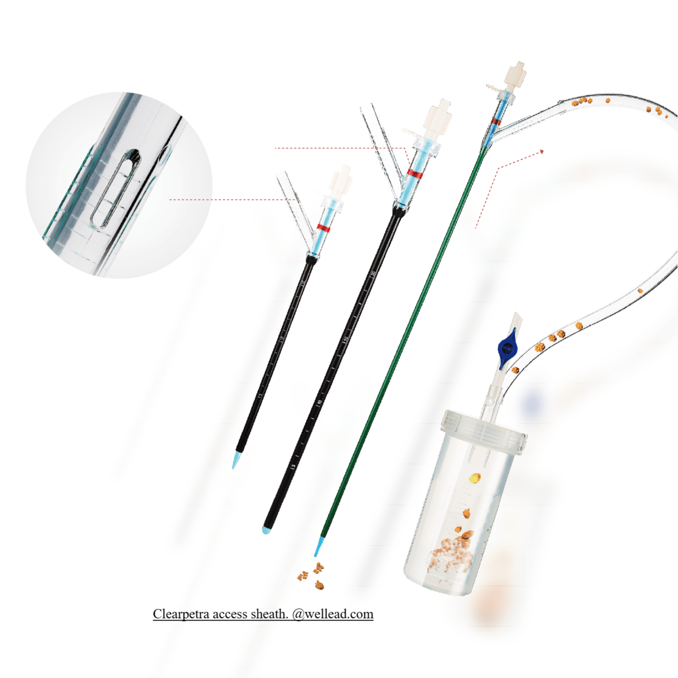 ClearPetra access sheath