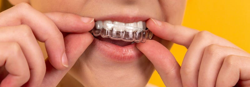 endométriose ostéopathie pour endométriose soulager douleurs endométriose traitement endométriose douleurs pelviennes endométriose ostéopathe endométriose Paris ostéopathie et fertilité stades endométriose soins complémentaires endométriose soulagement do